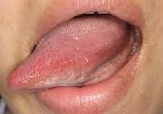 舌の付け根までしっかり出して見ましょう